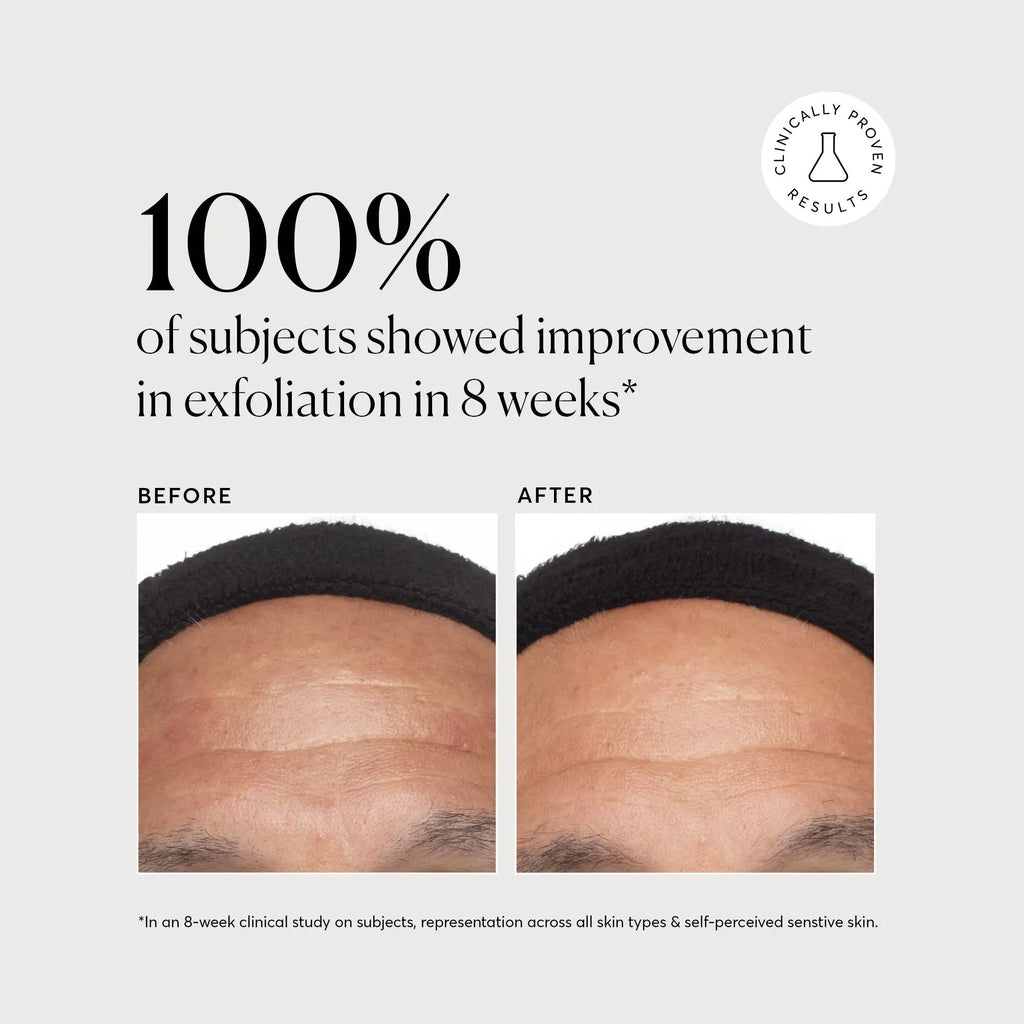 Azelaic Acid Derivative Complex 10% Simple Care Routine Essential
