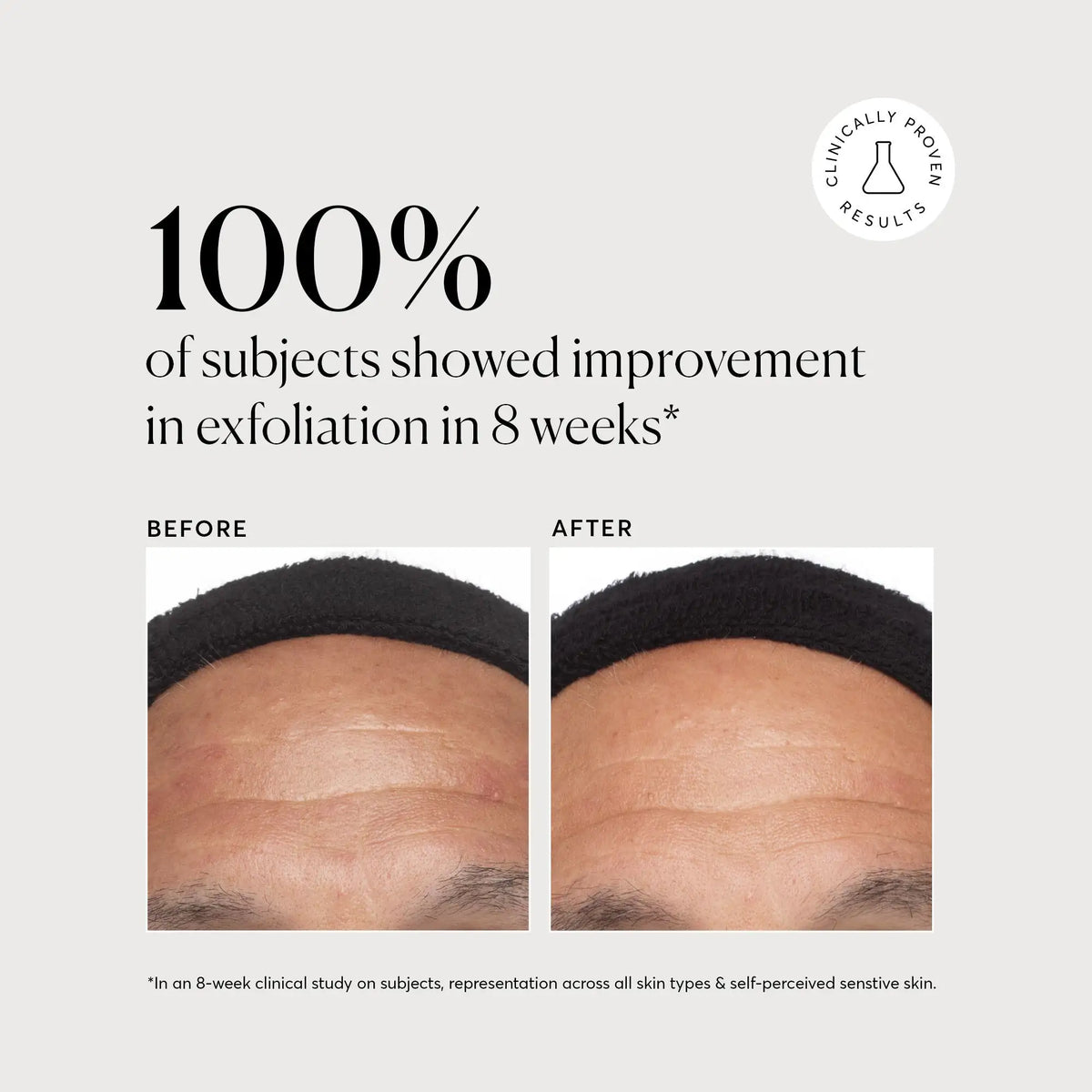 Azelaic Acid Derivative Complex 10% Simple Care Routine Essential