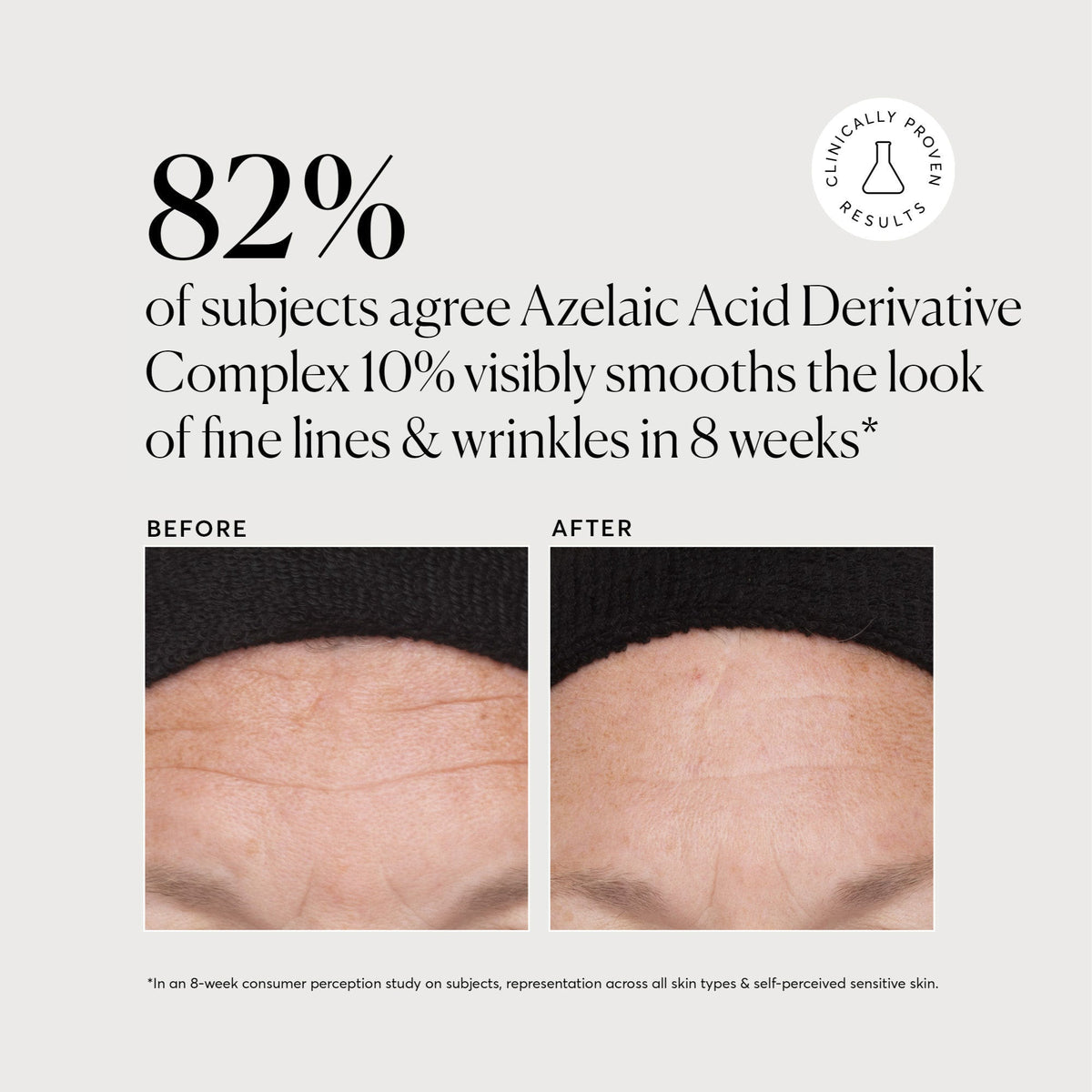 Azelaic Acid Derivative Complex 10% - Jumbo Weekend Evening Skincare Addition