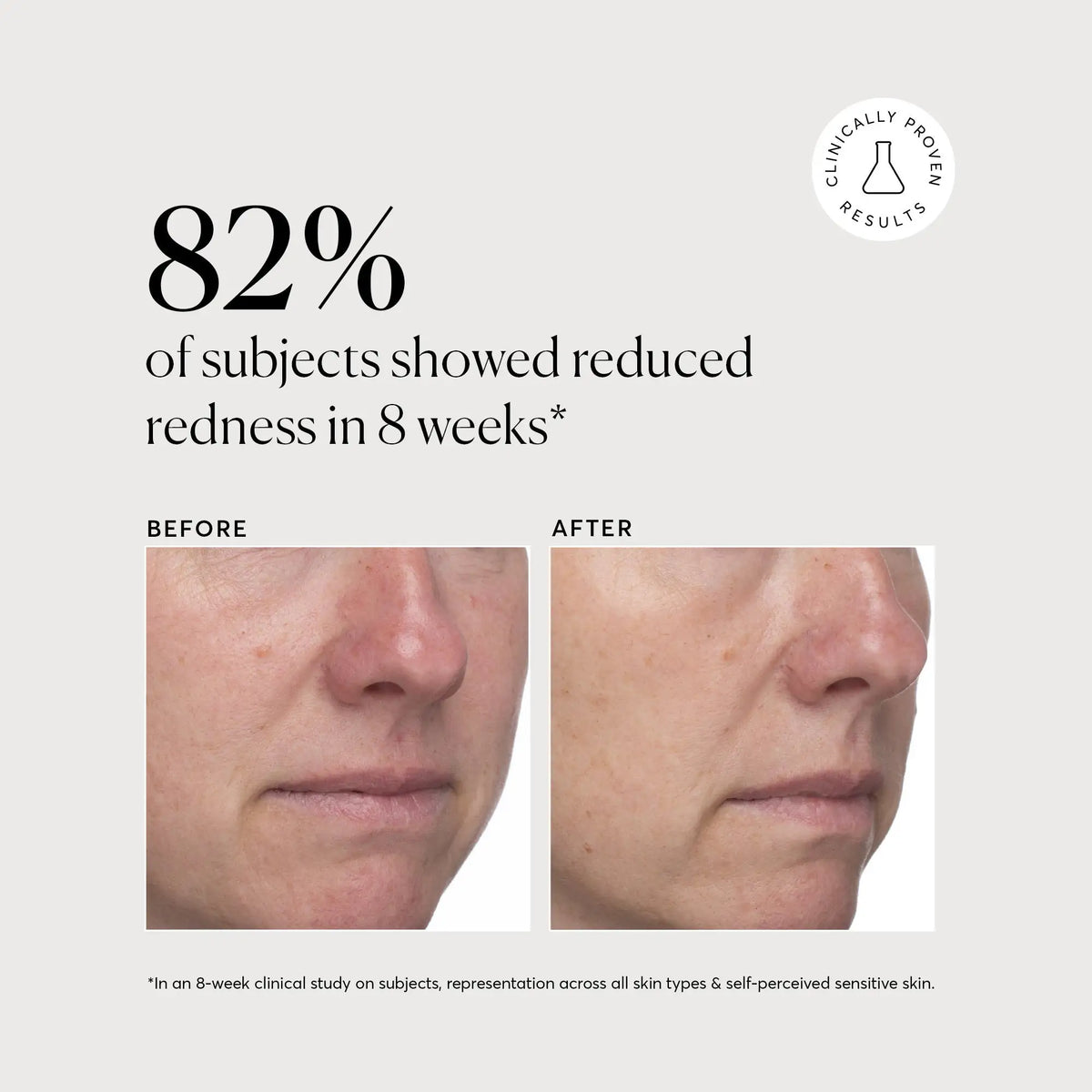 Azelaic Acid Derivative Complex 10% Simple Care Routine Essential