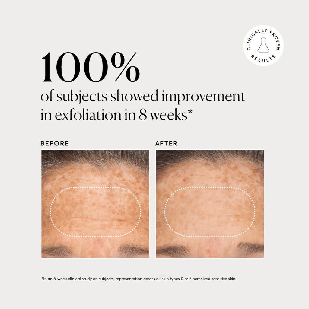 BHA Liquid Exfoliant 2% Weekend Skincare Routine Essential