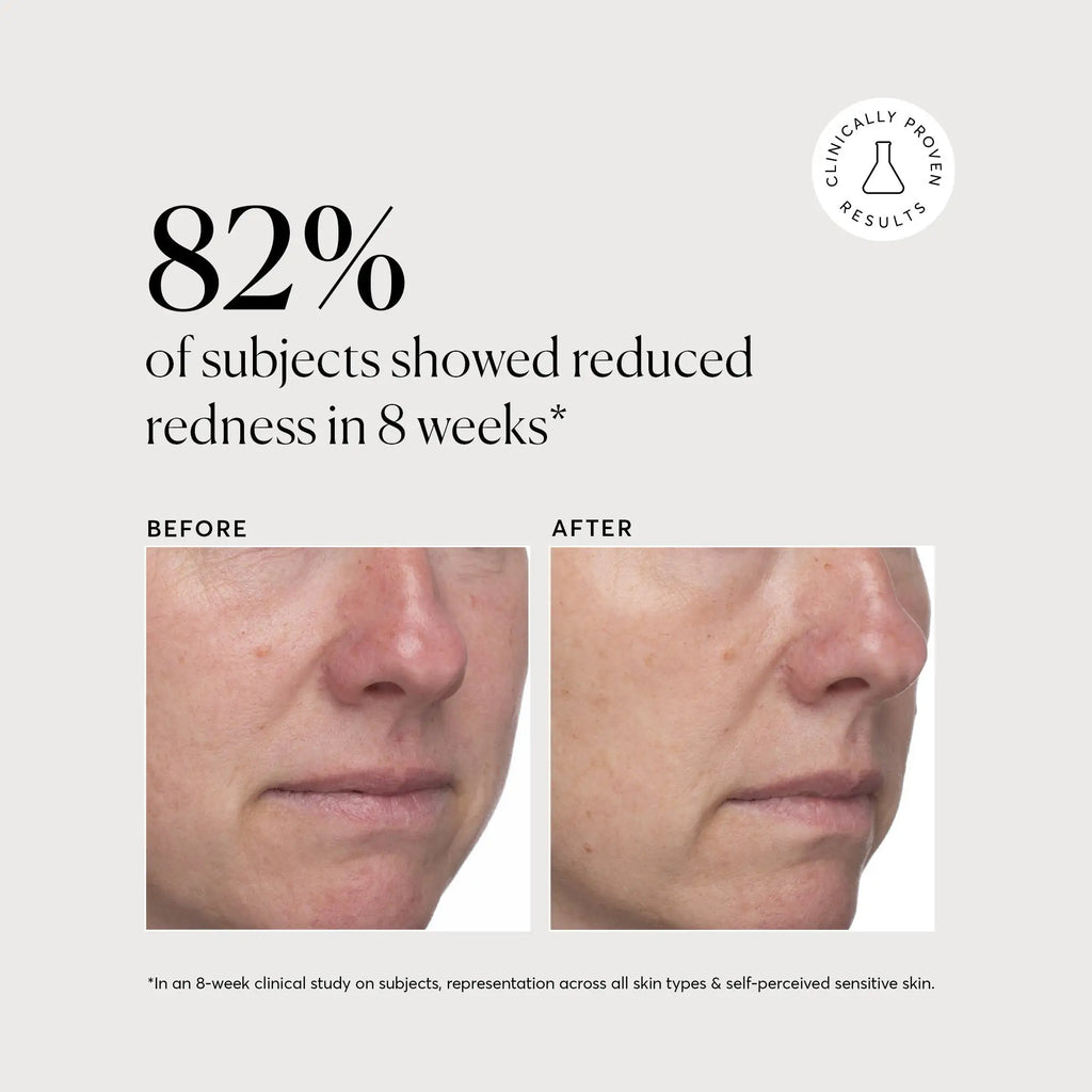 Azelaic Acid Derivative Complex 10% - Jumbo Weekend Evening Skincare Addition